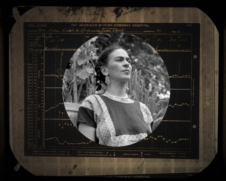 ‘Kahlo without Borders’ Exhibit Provides Intimate Look Into Frida Kahlo’s Life, Health Issues